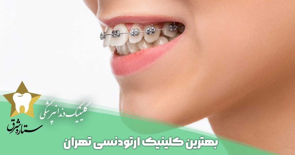 بهترین کلینیک ارتودنسی تهران