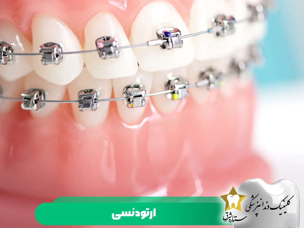 ارتودنسی