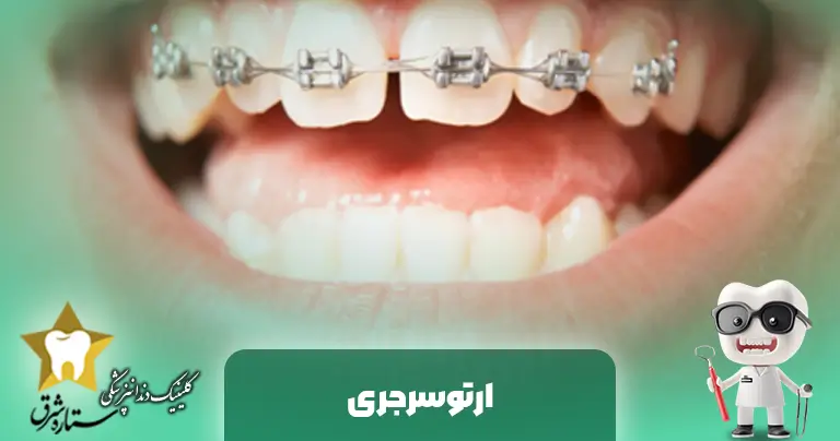 رابطه ارتودنسی با جراحی فک | ارتوسرجری