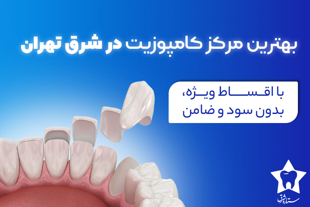 کامپوزیت اقساطی