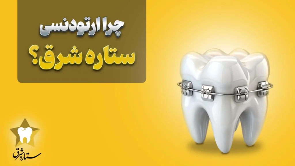 مرکز ایمپلنت شرق تهران