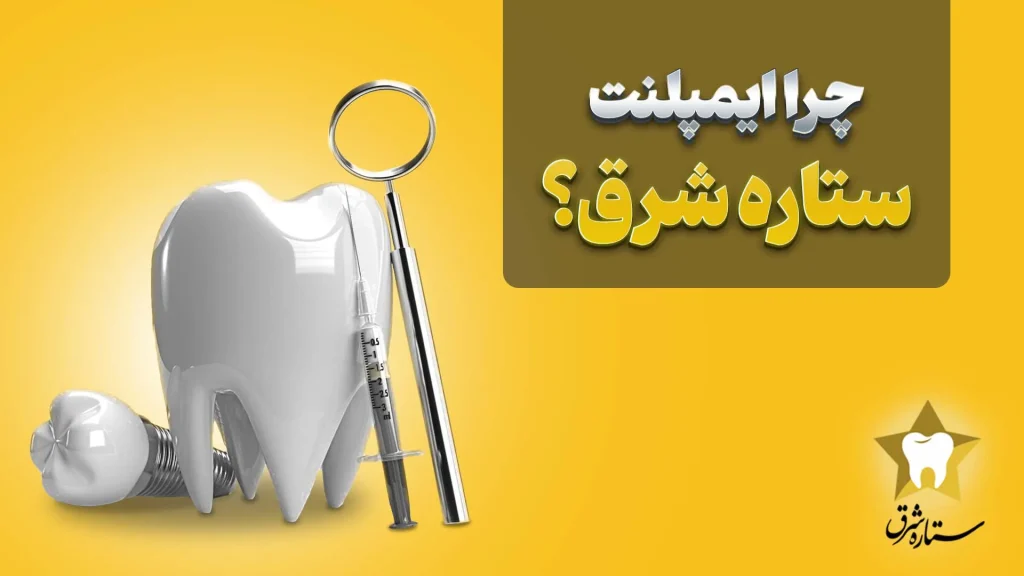 بهترین ایمپلنت شرق تهران