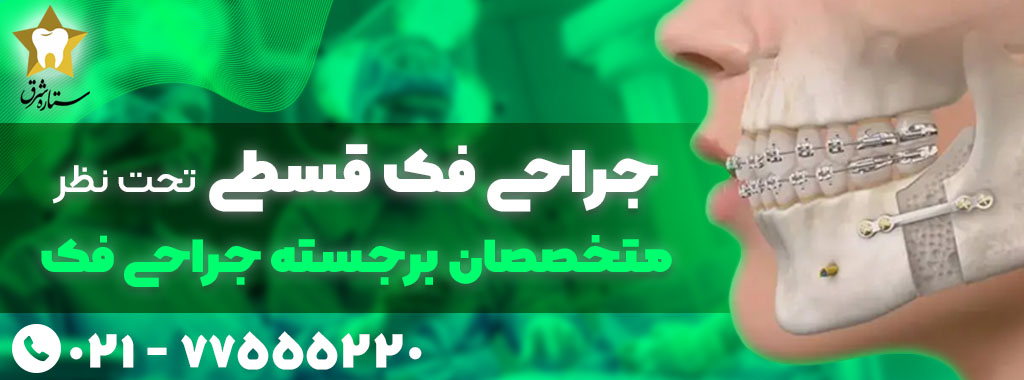 جراحی فک اقساطی در شرق تهران
