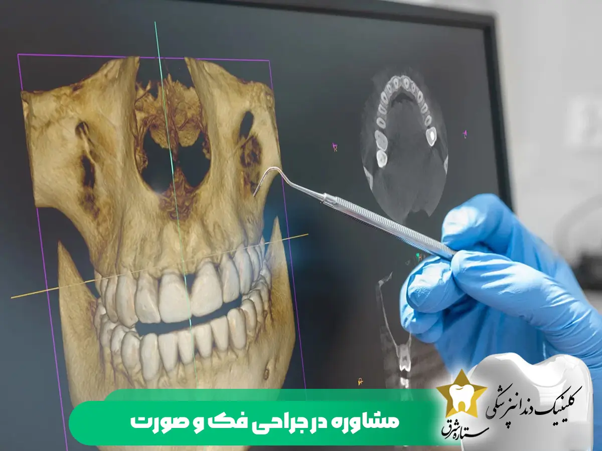 مشاوره در جراحی فک و صورت