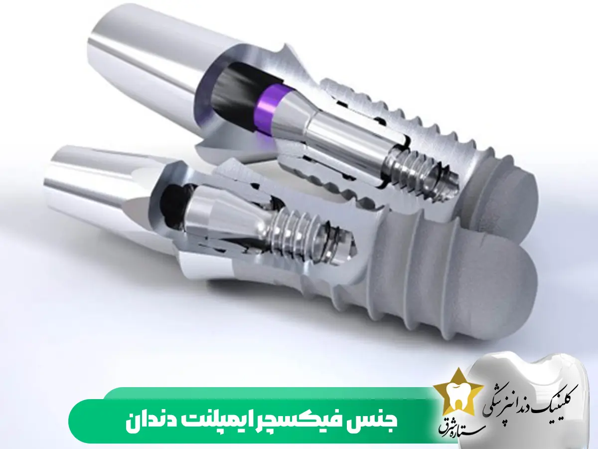 جنس فیکسچر ایمپلنت