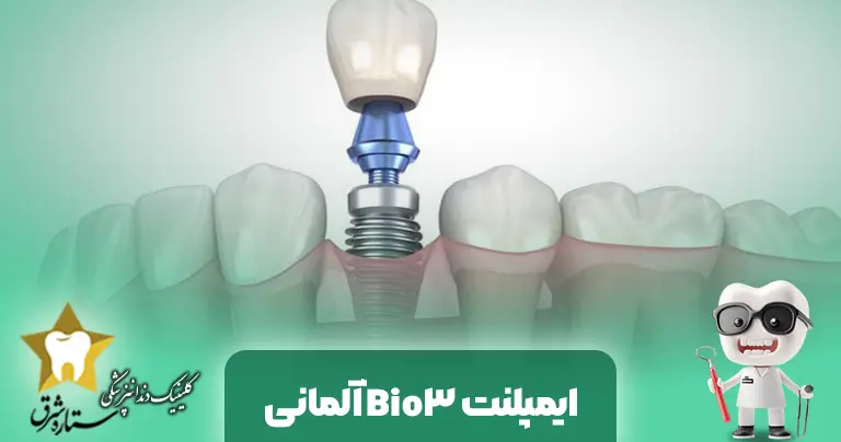 بررسی ایمپلنت Bio3 آلمانی