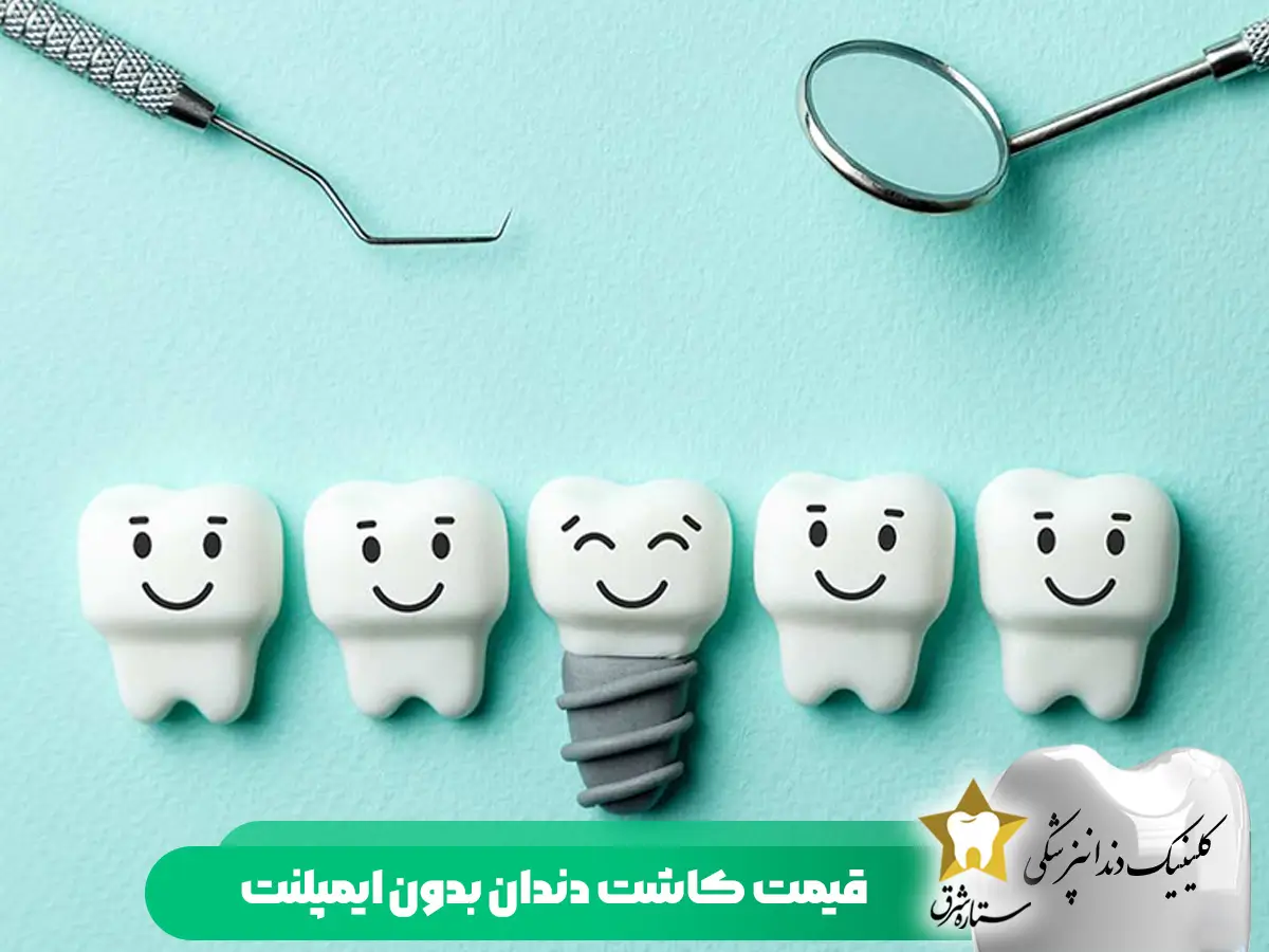 قیمت کاشت دندان ایمپلنت