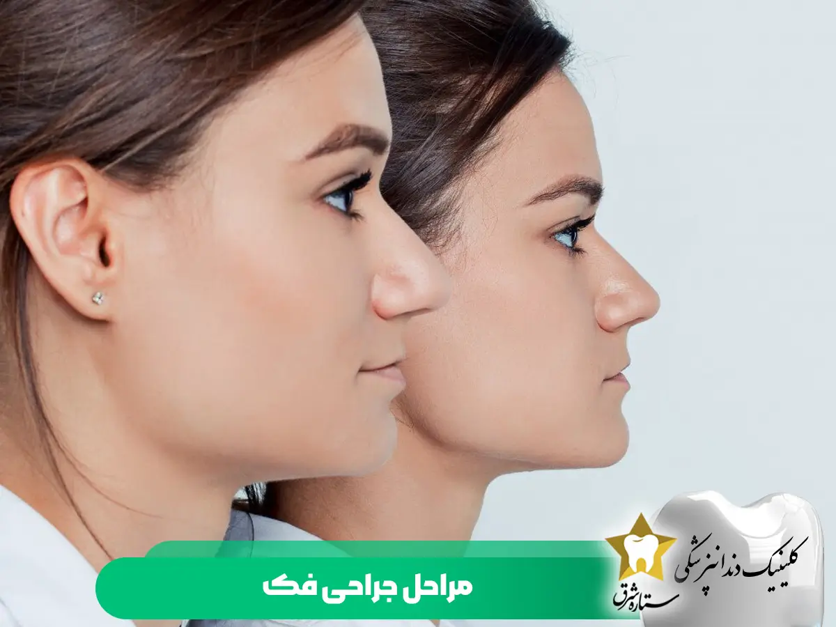 مراحل جراحی فک