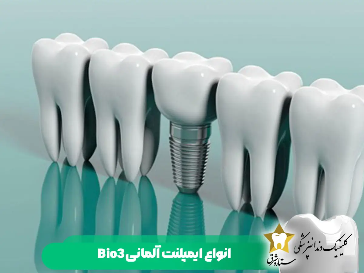 انواع ایمپلنت آلمانی Bio3