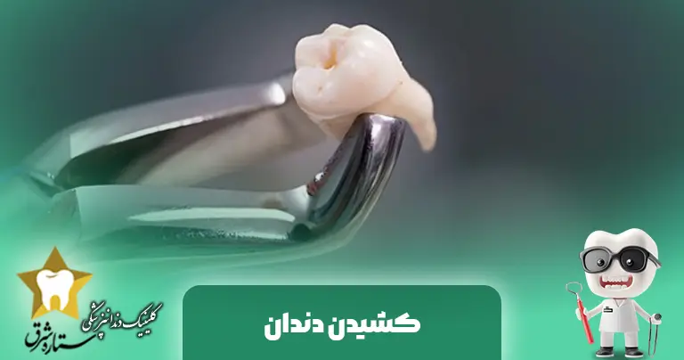 کشیدن دندان: هر آنچه باید قبل و بعد از آن بدانید