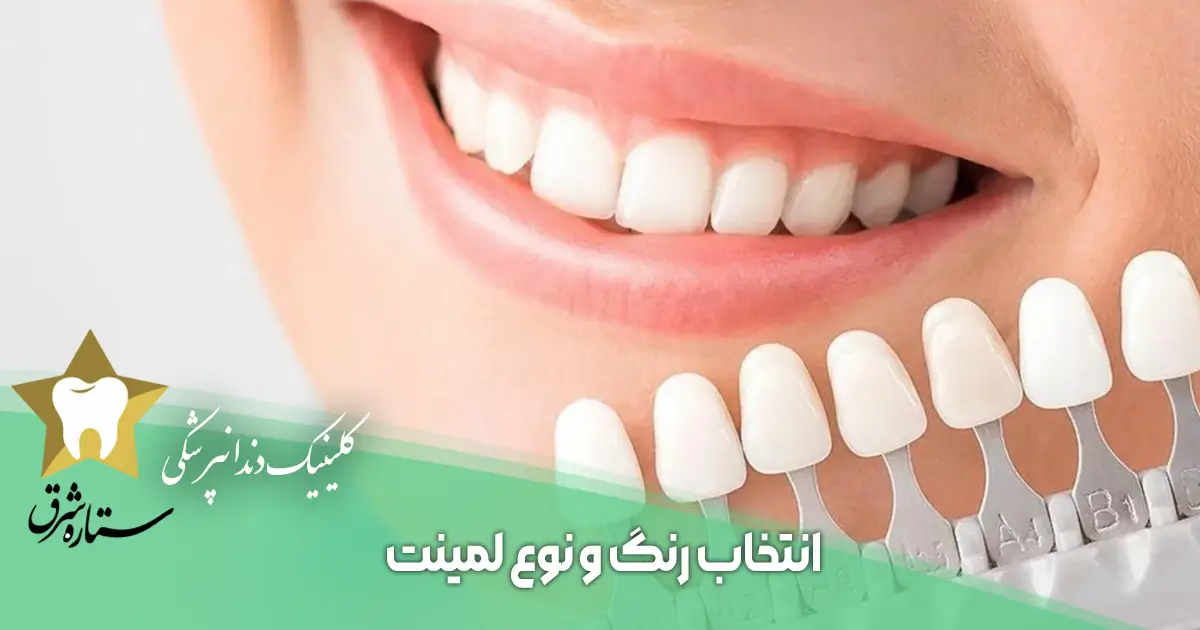 انتخاب رنگ و نوع لمینت