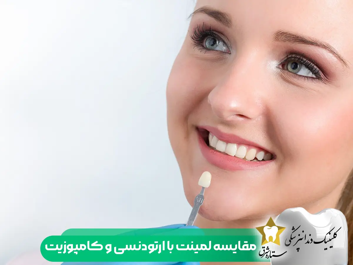 لمینت دندان جلو
