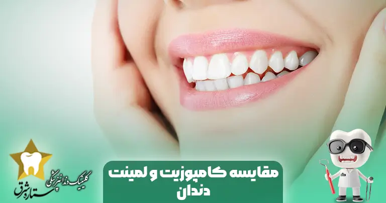 مقایسه کامپوزیت و لمینت دندان