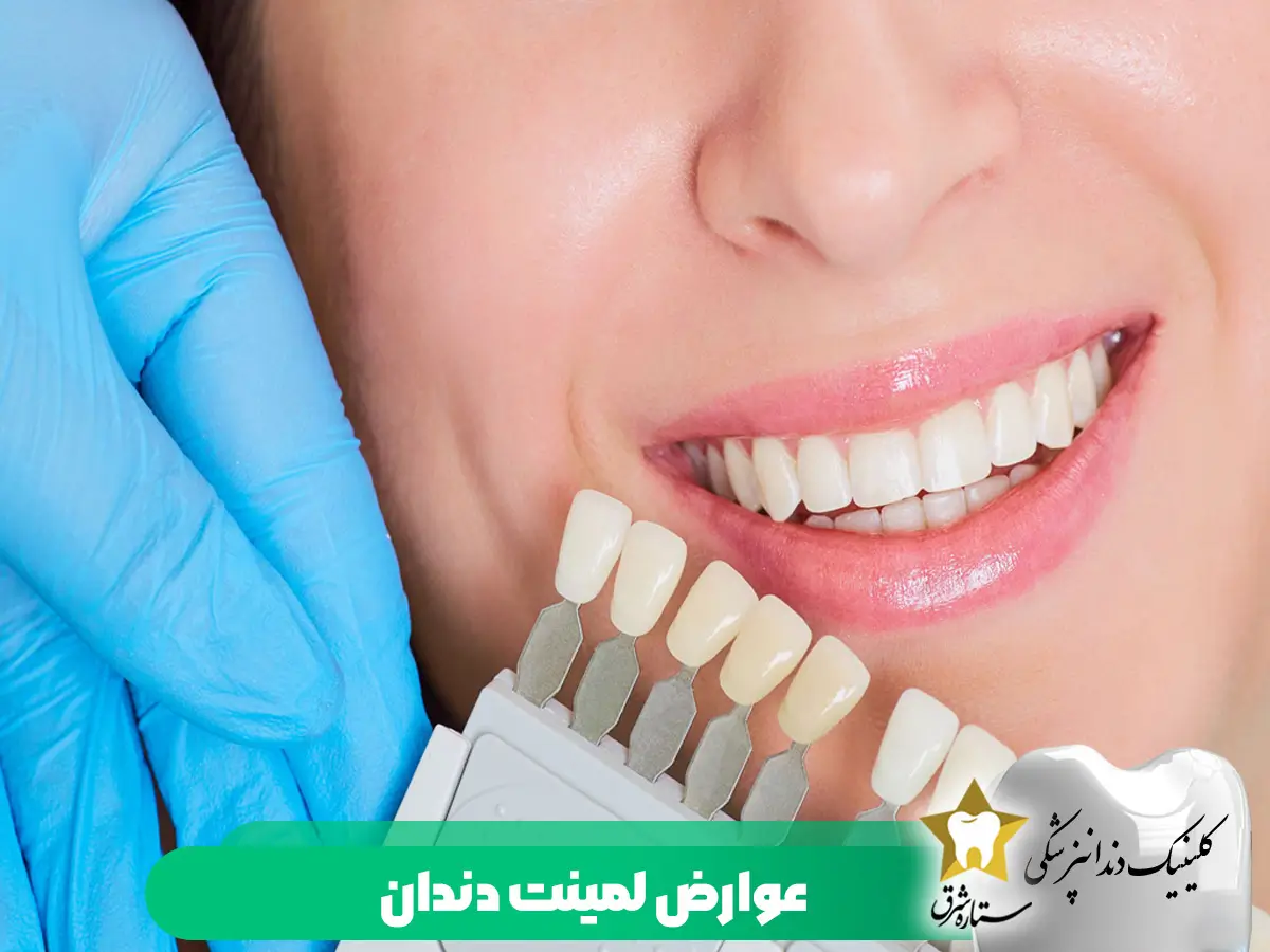 عوارض-لمینت