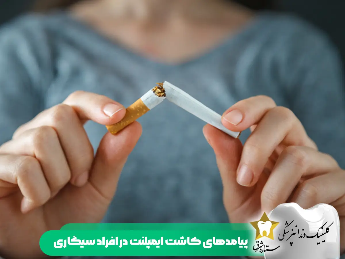 پیامدهای کاشت ایمپلنت دندان در افراد سیگاری