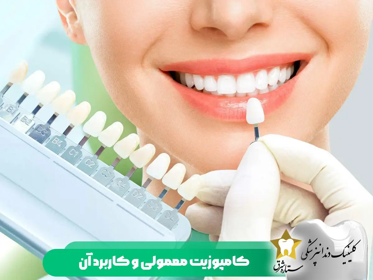 کامپوزیت معمولی و انواع آن