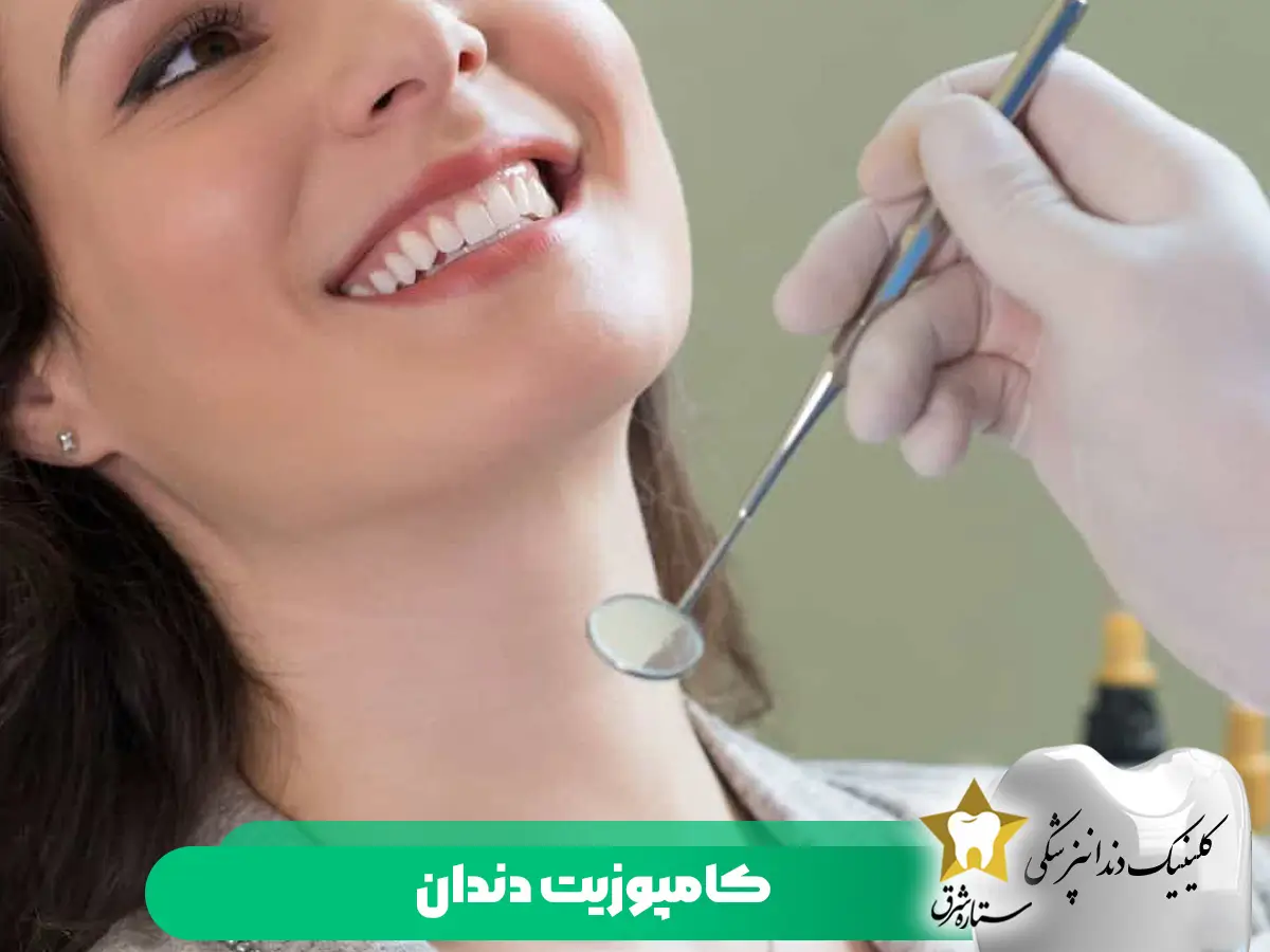 کامپوزیت دندان