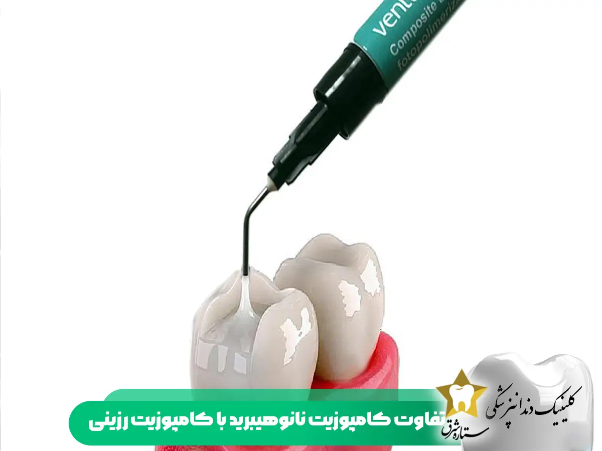 تفاوت کامپوزیت رزینی و نانو هیبرید