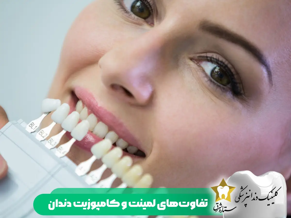 تفاوت های لمین و کامپوزیت دندان