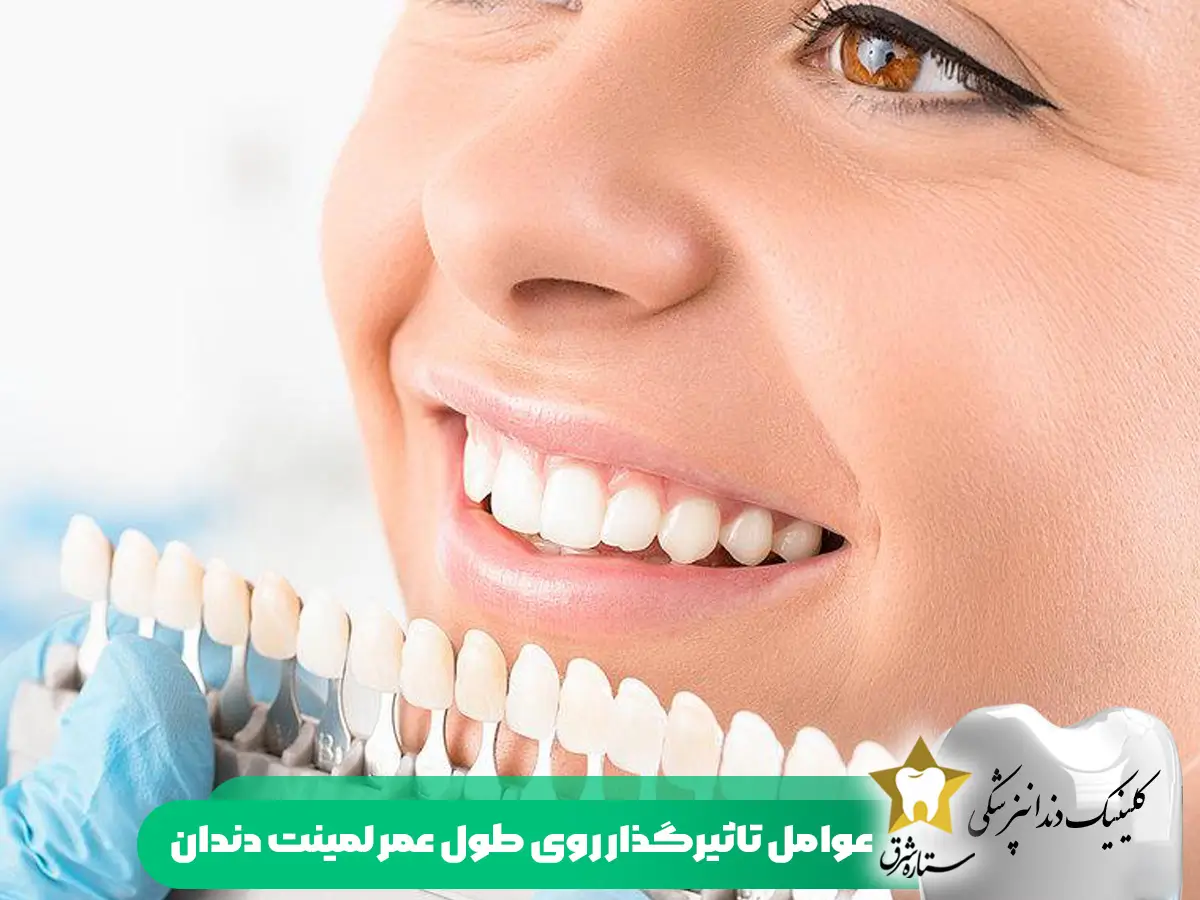 عوامل تاثیرگذار بر طول عمر لمینت دندان