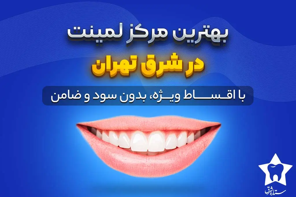 لمینت اقساطی شرق تهران