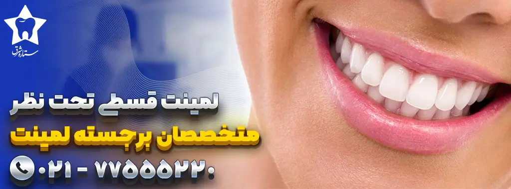 لمینت قسطی دندان