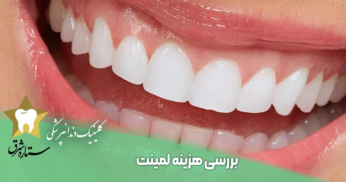 بررسی هزینه لمینت