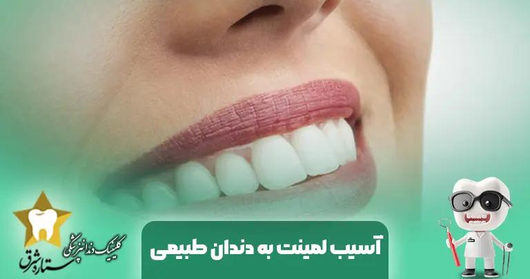 آسیب-لمینت-به دندان-طبیعی
