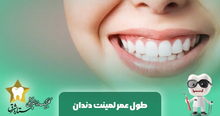طول عمر لمینت دندان