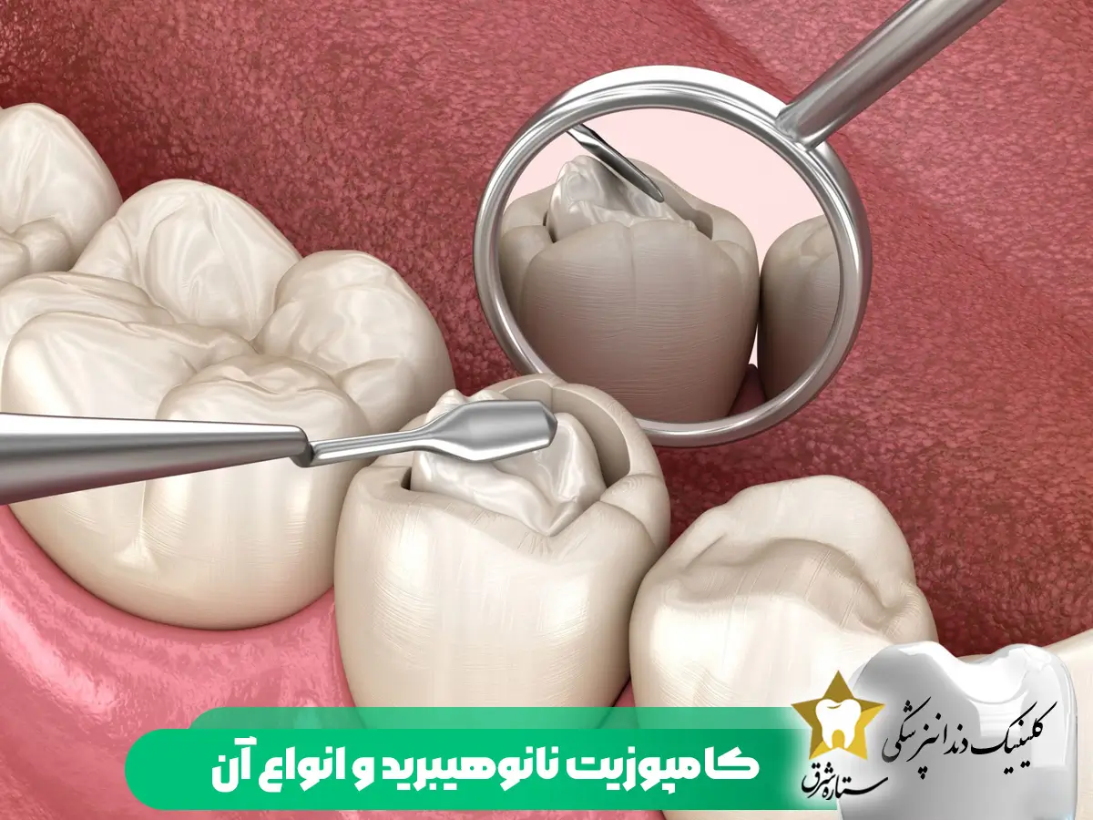 انواع کامپوزیت نانو هیبرید