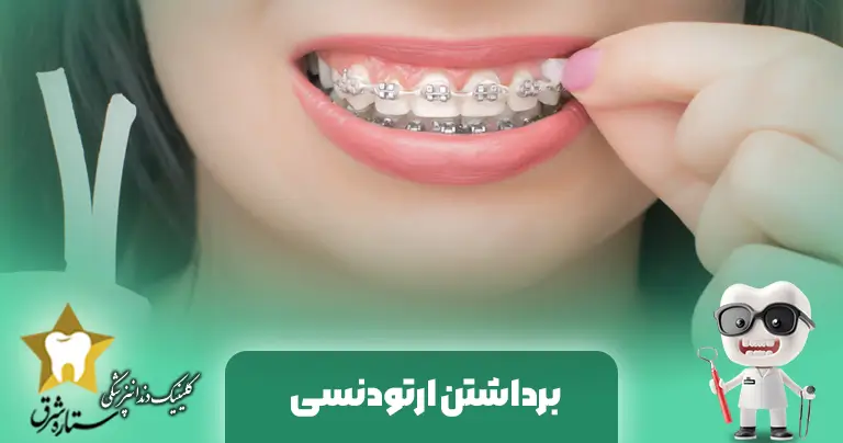 برداشتن-ارتودنسی