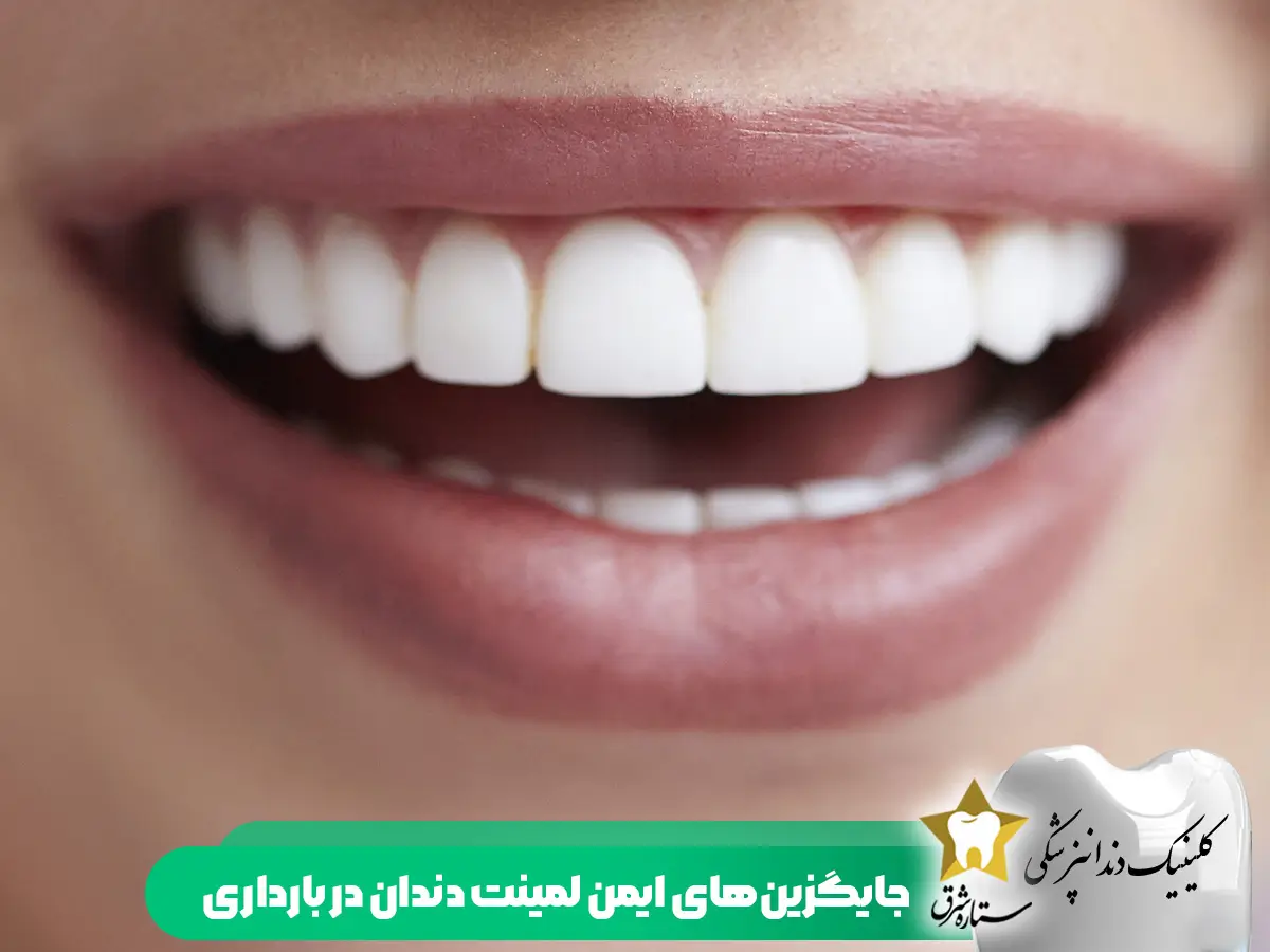 جایگزین های لمینت دندان در بارداری