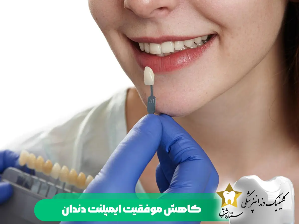کاهش موفقیت ایمپلنت دندان
