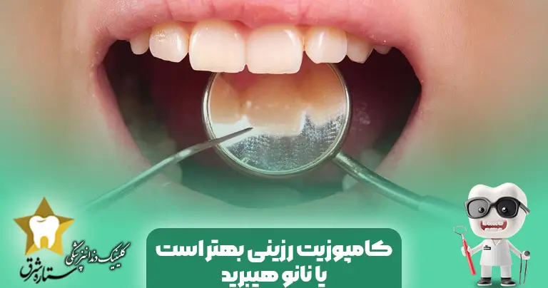 تفاوت کامپوزیت رزینی و نانوهیبرید