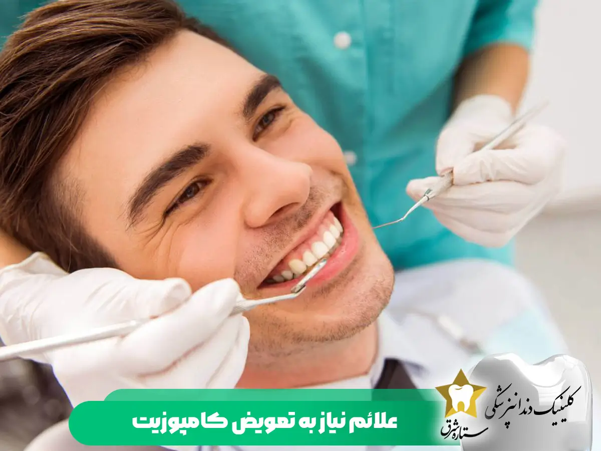 علائم-نیاز به تعویض کامپوزیت