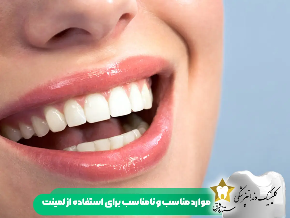 موارد مناسب و نامناسب برای لمینت