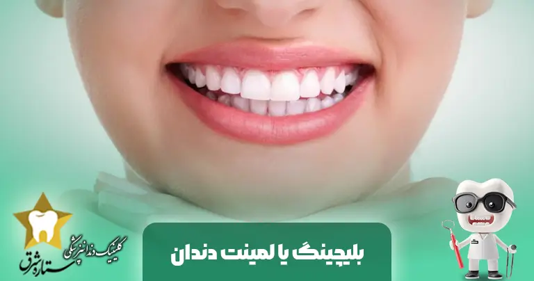 بلیچینگ-یا-لمینت دندان
