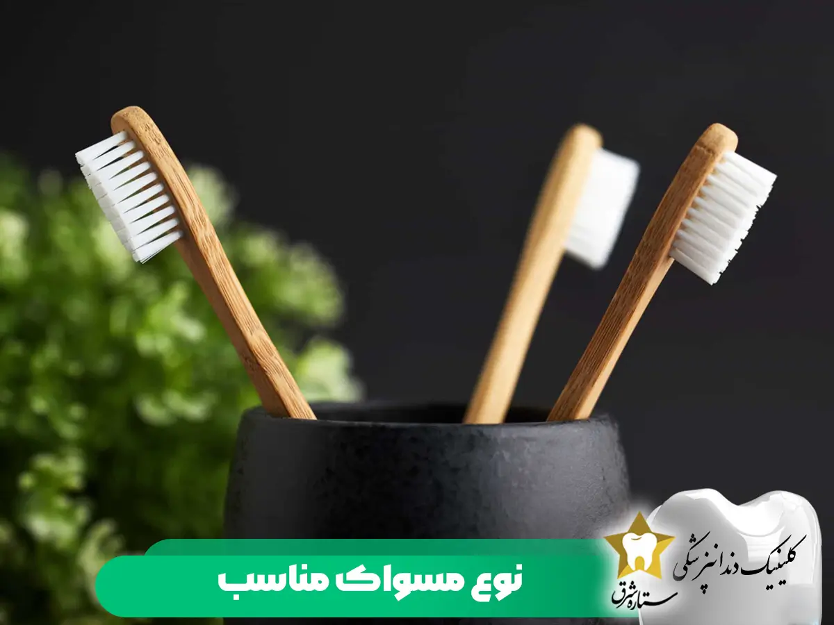 نوع-مسواک-مناسب