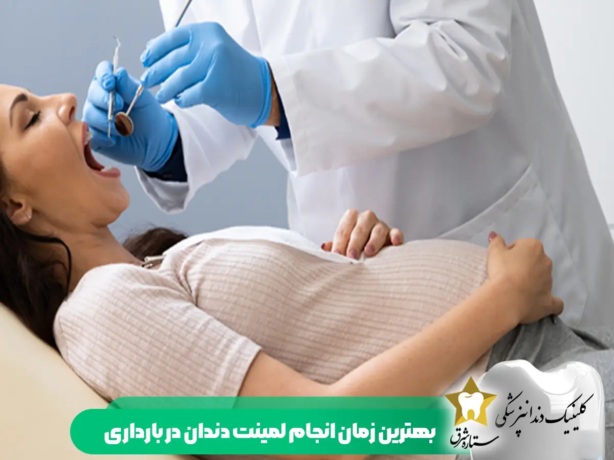بهترین زمان لمینت دندان در بارداری