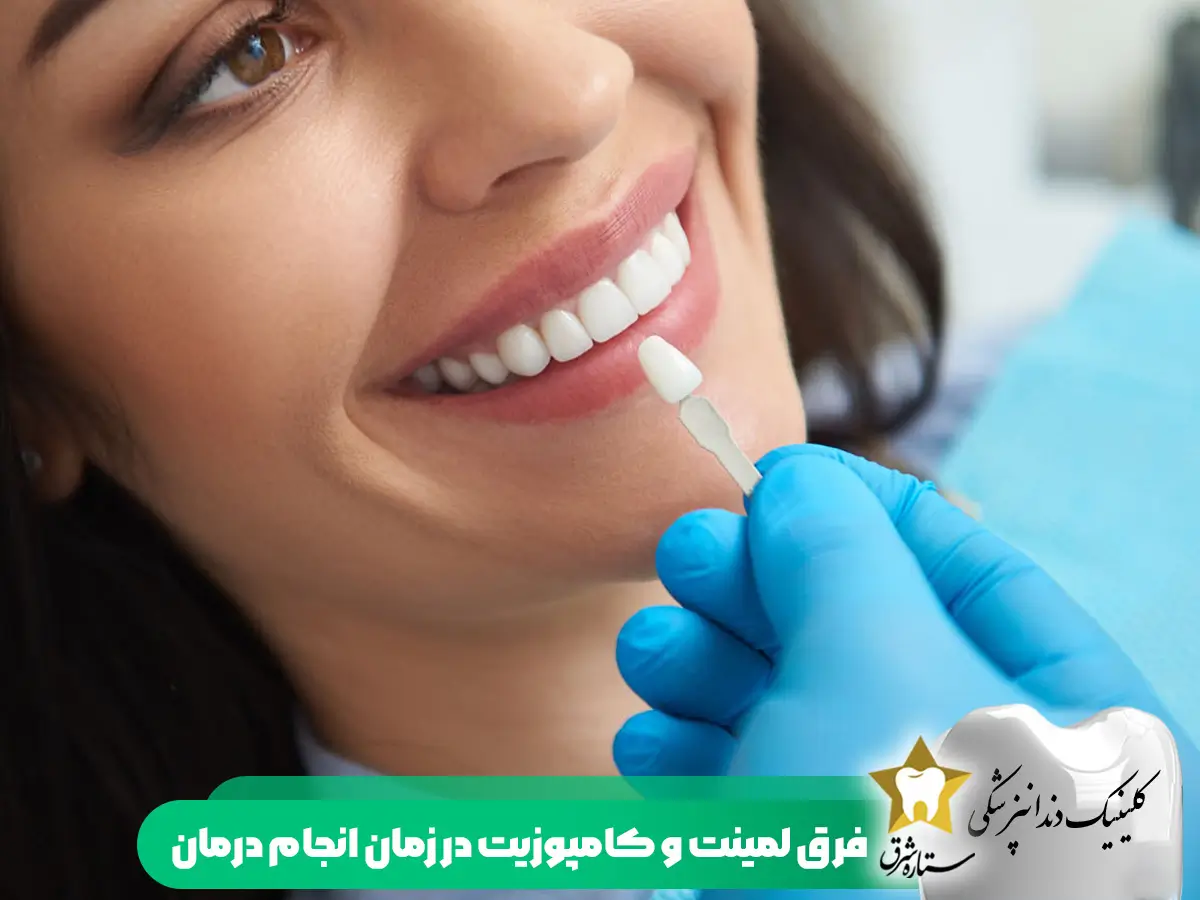 فرق لیمنت و کامپوزیت در زمان انجام کار