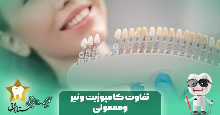 تفاوت کامپوزیت وینر و معمولی