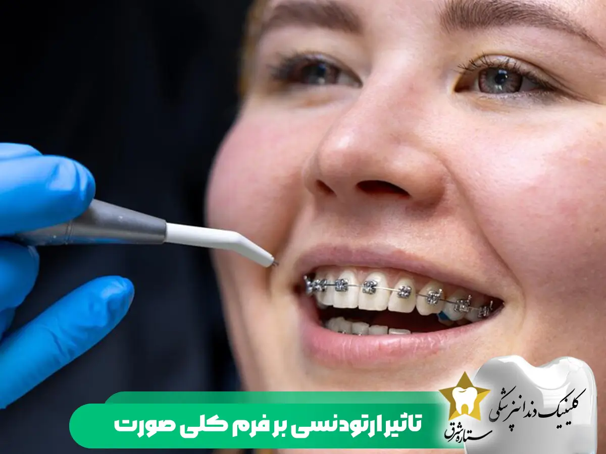 تاثیر ارتودنسی بر فرم صورت