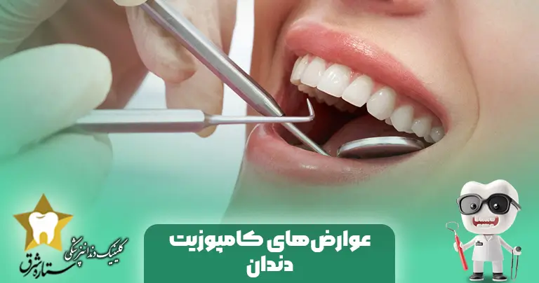 عوارض های کامپوزیت دندان