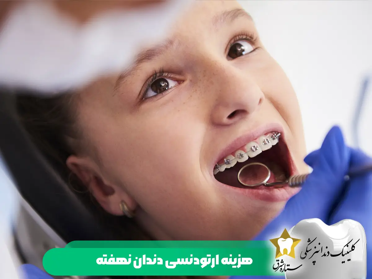 هزینه ارتودنسی دندان نهفته
