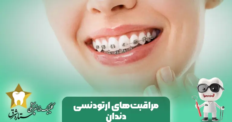 مراقبت‌های بعداز ارتودنسی دندان