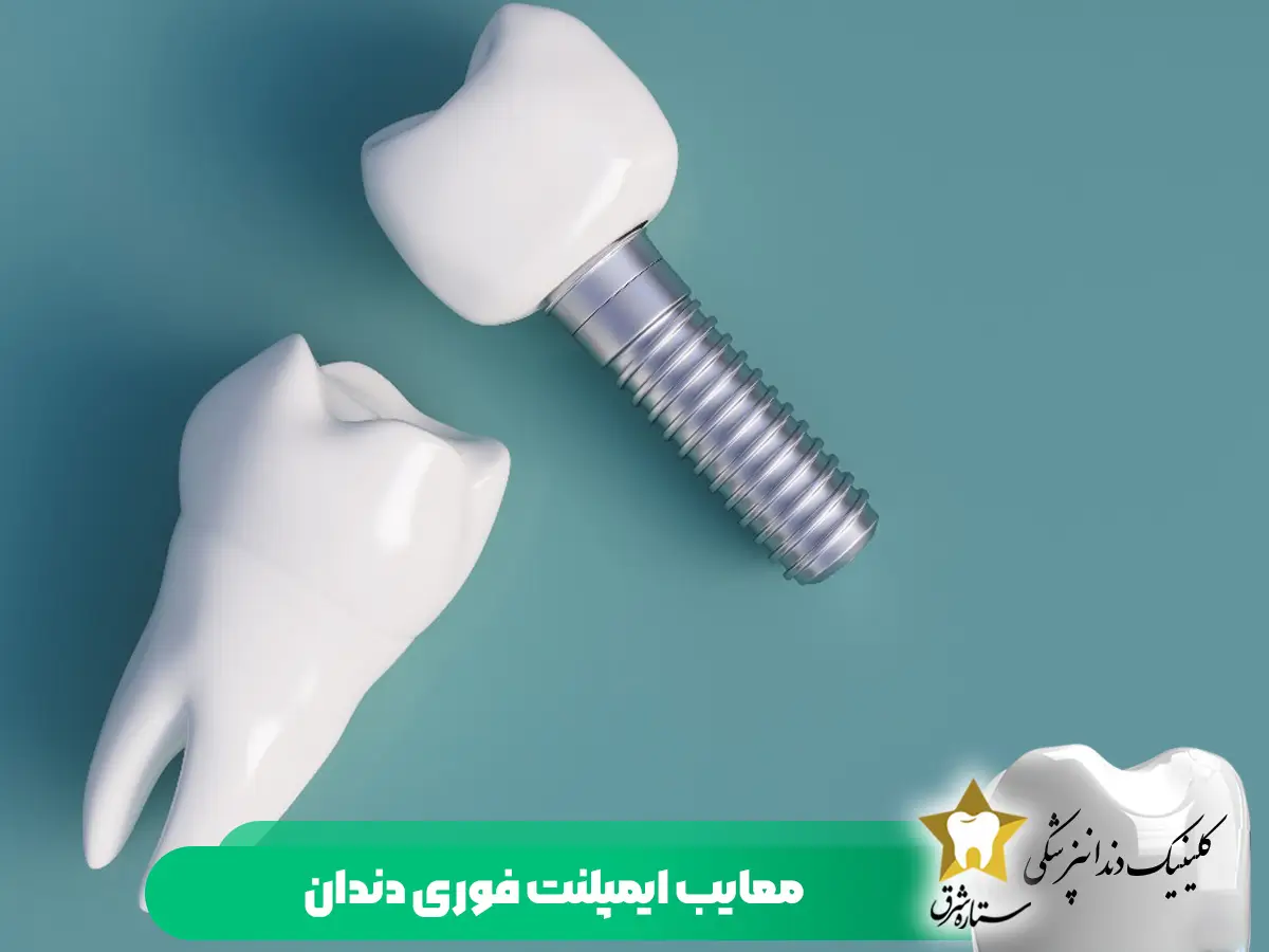 معایب ایمپلنت فوری دندان