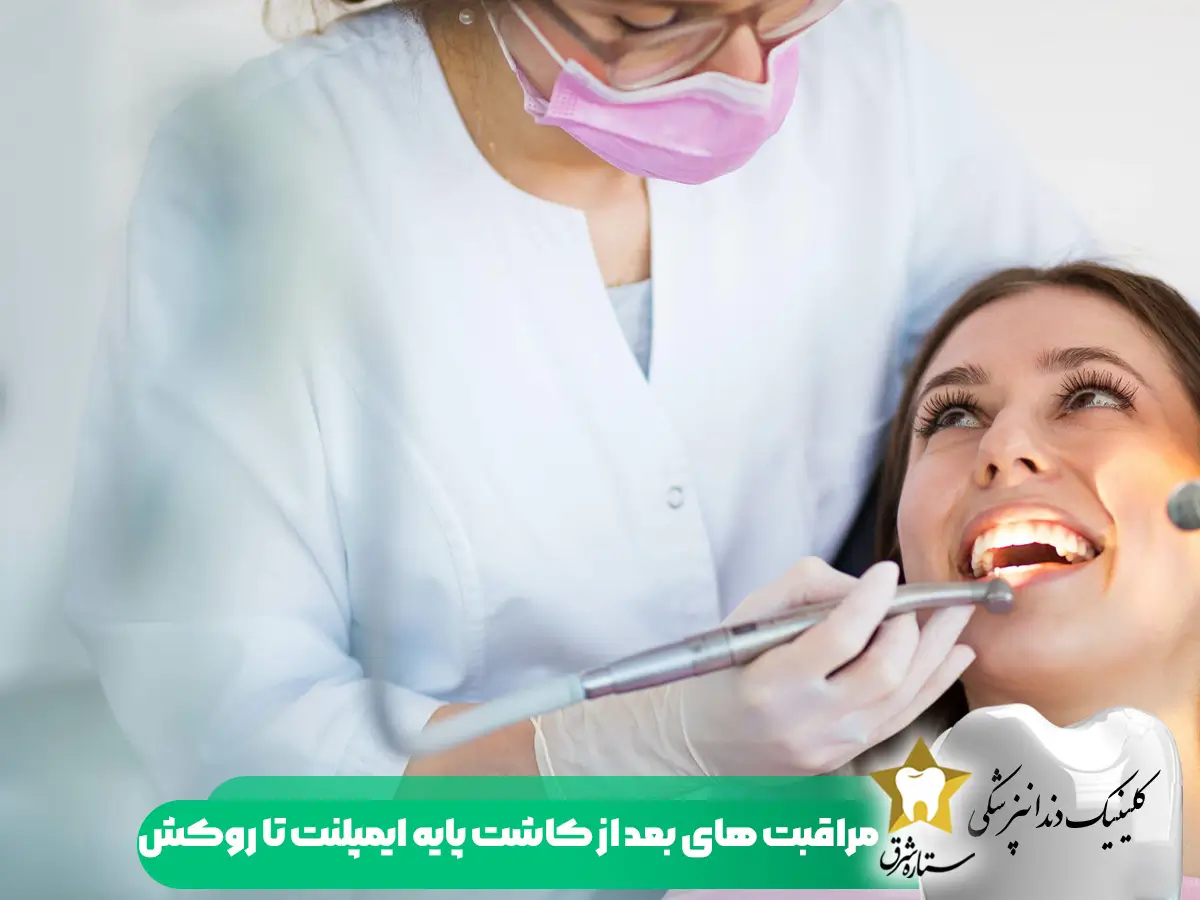 مراقبت های بعد از کاشت پایه ایمپلنت تا روکش