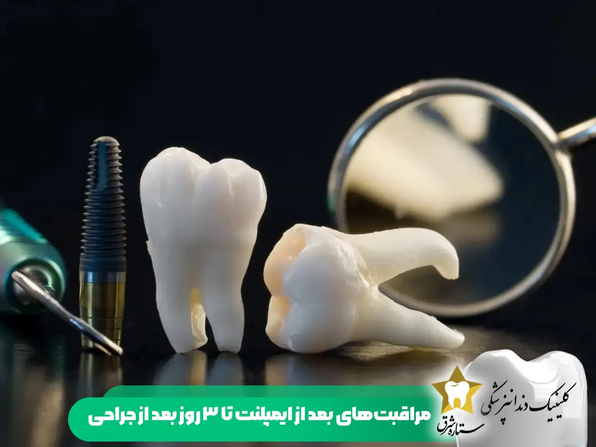 مراقیت های بعد از ایمپلنت تا سه روز بعد از جراحی