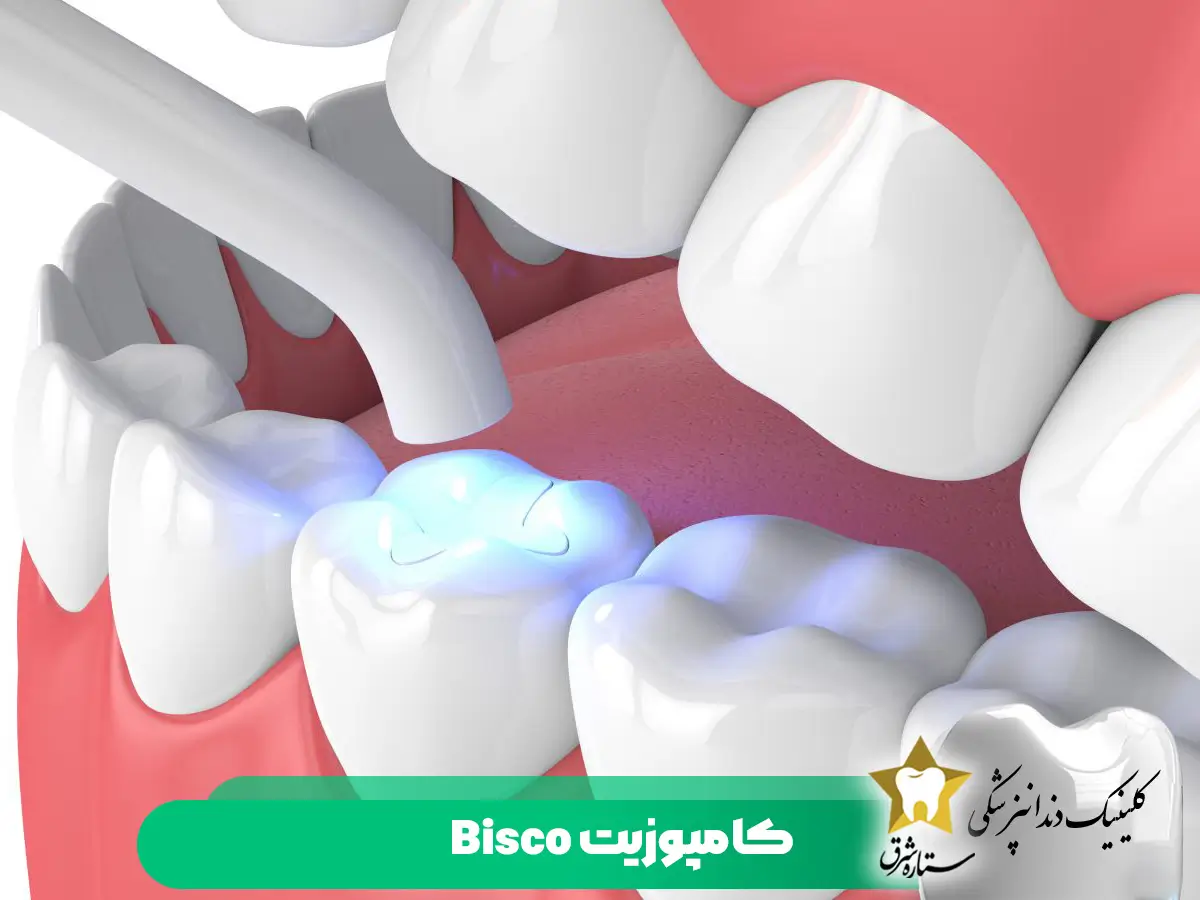 کامپوزیت bisco