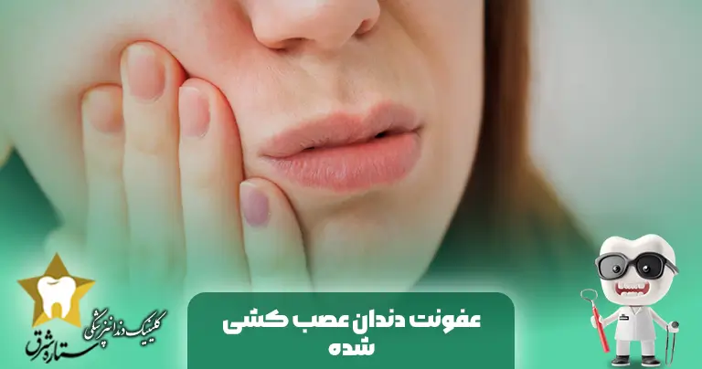 عفونت دندان عصب کشی شده